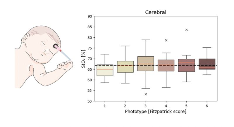 New Study Reveals Negligible Impact of Skin Pigmentation on TD-NIRS Tissue Oximetry